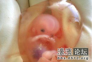 胎儿取出时透明的羊膜囊依然完整,浸在羊水中犹如琥珀中的化石,妇产科