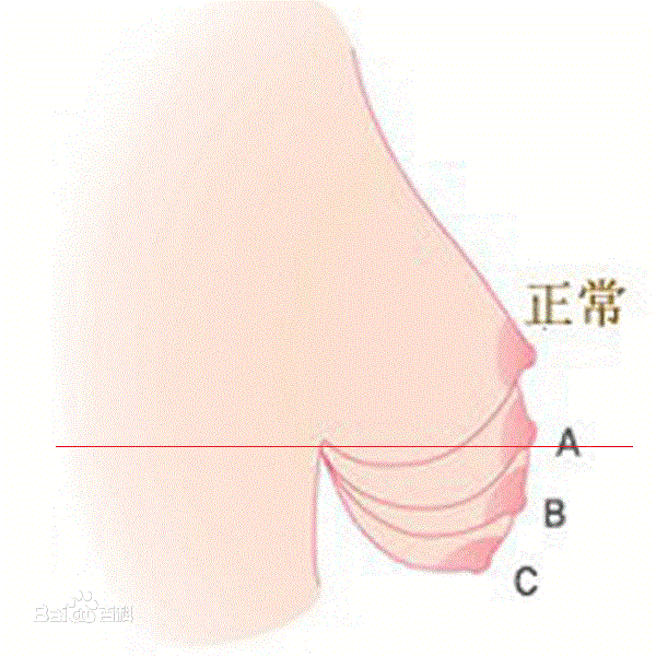 <em>文胸穿</em>得<em>不合适</em>问题多,要格外用心选购(多图) 
