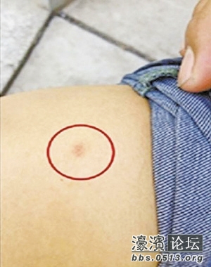 【教育新闻】幼儿园老师被指针扎孩子 副园长自扎针证