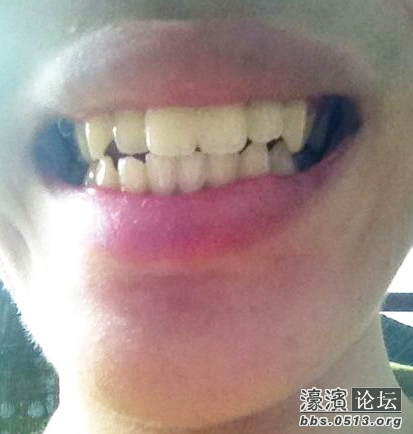 牙齿照片.jpg