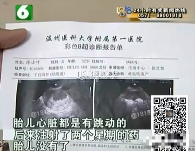 134726pv11h1jrmnhwemmu.jpg