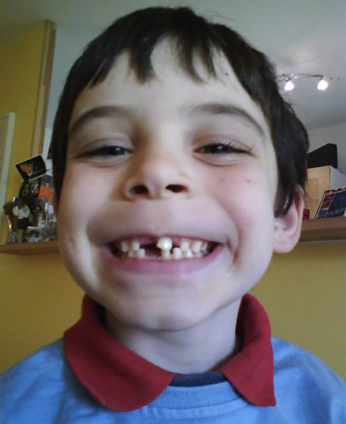 孩子为啥害怕这些？挠破头你都想不明白