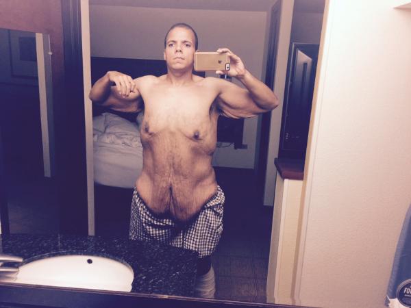 592斤大胖子的逆袭！两年减肥全美直播狂瘦270斤