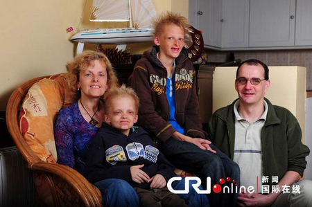 乔治和西蒙一家，照片显示，他们的父亲容貌正常，而母亲的容貌与常人略有差异，眉毛稀少，因此可推测，兄弟俩的EDA突变基因遗传自母亲。图片来自http://www.ce.cn/xwzx/kj/201011/09/t20101109_21953384.shtml