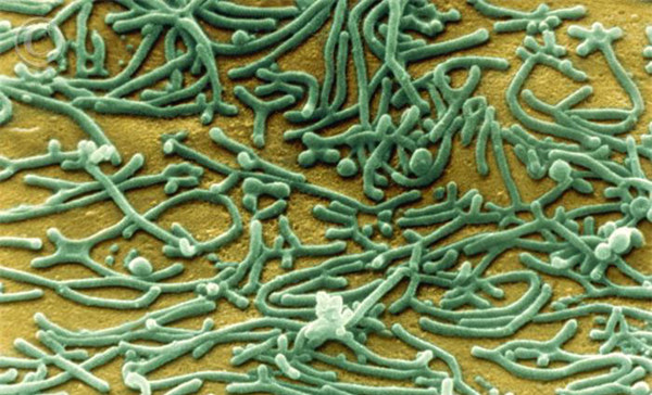 支原体的扫描电镜图。值得一提的是，世界上首例人造生命辛西娅(Synthia)，就是使用支原体的遗传物质构建，原因还是因为小，容易操作。