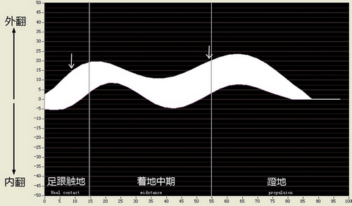 汇集很多长跑而没有受伤的人的足底数据，绘制成周正区间。