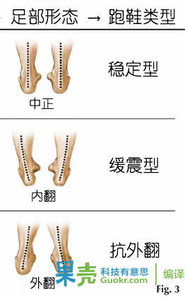 如果一只脚周正，一只外翻，建议买抗外翻，因为中正的脚穿抗外翻鞋也不一定有危险，但是如果外翻的脚穿了中正的鞋，外翻的脚一定会加重。