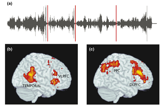 在乐章的交替处，人们的右半球脑部活动会发生改变。其中TEMORAL即PTC。图片来自文献[3]。