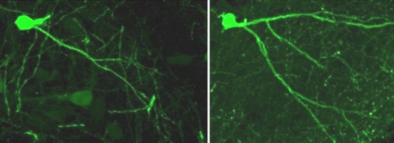 紧张沮丧情绪下的小鼠表现出神经元活性降低的现象（左），但在影响其神经突蛋白之后小鼠的神经元活性又恢复到了正常水平（右）。