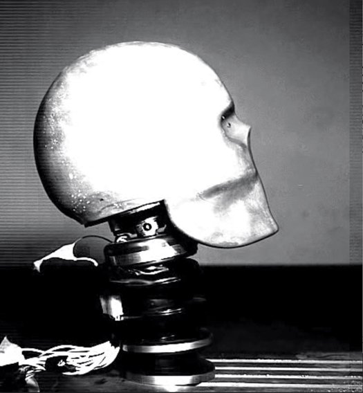 这是一个人造的机械头骨，皮肤是硅胶，颅骨是聚氨酯。颅骨内有仿制的脑脊液和用粘硅胶做成的大脑，其大小形状和密度都仿照真人做成的。