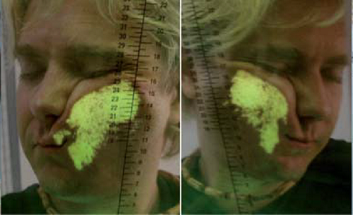 绿色是与枕头接触的部位。很明显，眼下有褶皱被挤出来了。