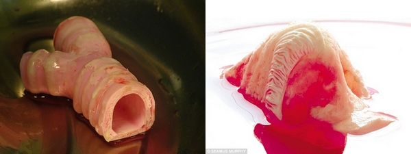 人工合成的气管和鼻子。