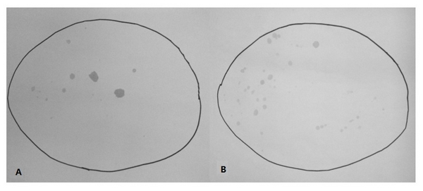 图2。“虹吸式”马桶（A）与“无框式”马桶（B）溅水程度的比较 [1]。