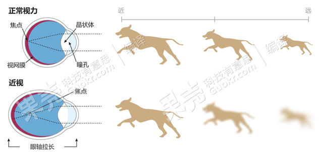 宅出来的近视眼