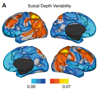 大脑结构影响思维方式？神经成像揭示人脑个体差异
