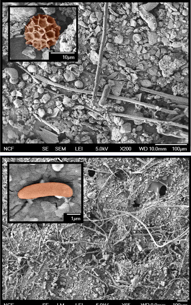 在马桶圈和枕套上，来一场探索大冒险