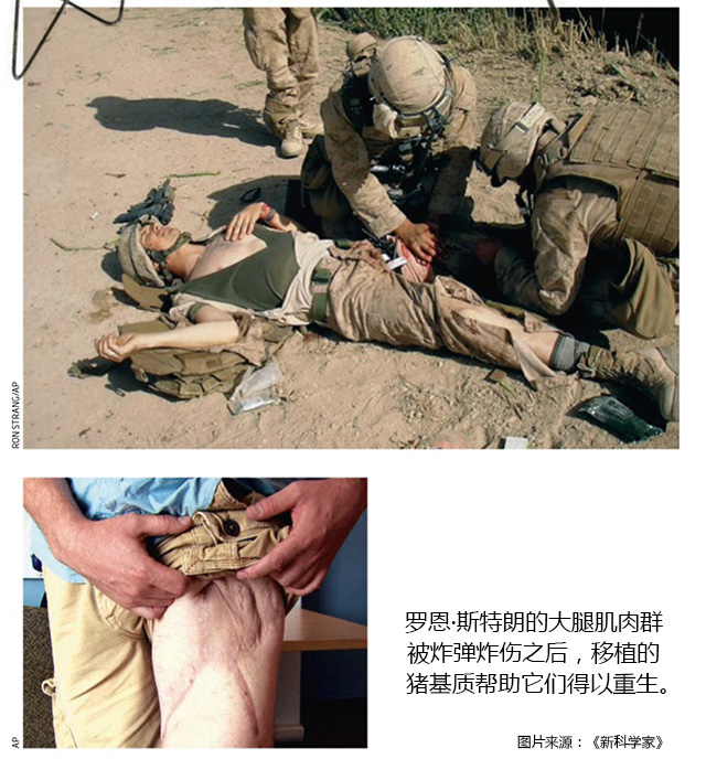 再生不是梦：用Matrix重建你的身体