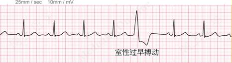 窦性心率不齐别着急，跟着豪斯医生学看心电图