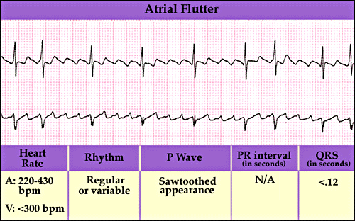 窦性心率不齐别着急，跟着豪斯医生学看心电图