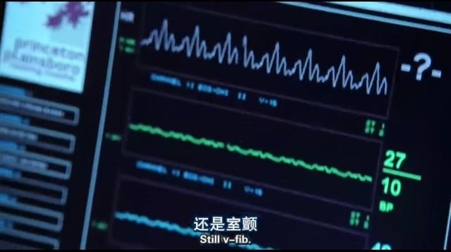 窦性心率不齐别着急，跟着豪斯医生学看心电图