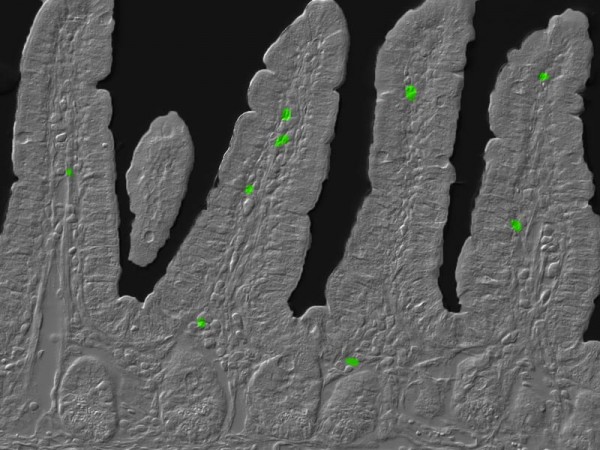 快关掉电脑，丢开手机，熬夜真的破坏你的免疫系统！