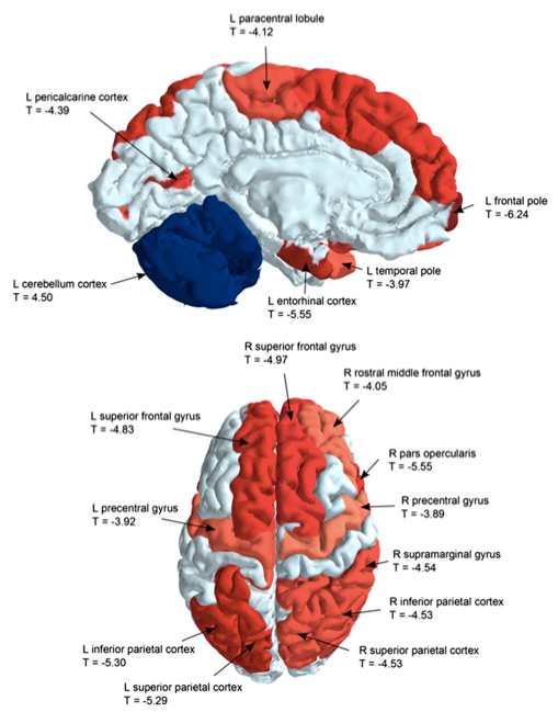为何难懂女人心，大脑“电路”不一样！