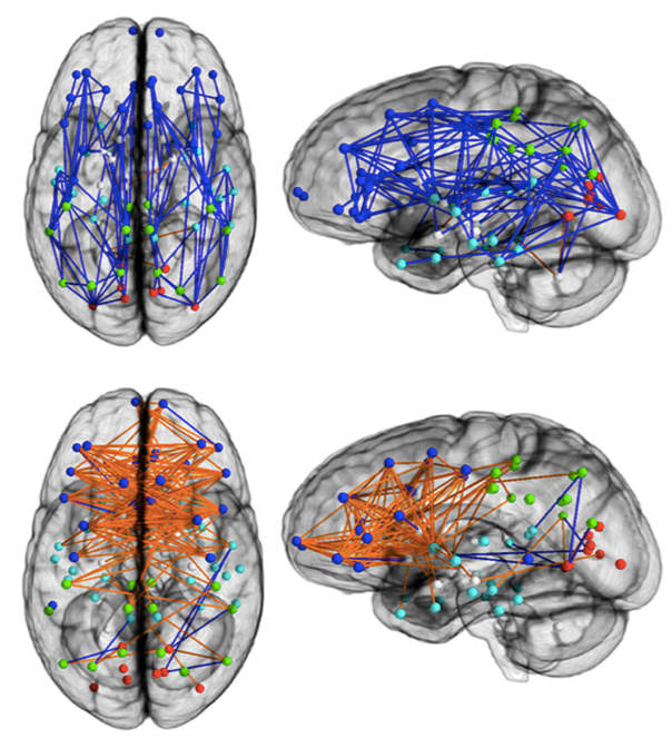 为何难懂女人心，大脑“电路”不一样！
