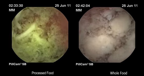 3分钟泡的方便面32小时都不能消化？