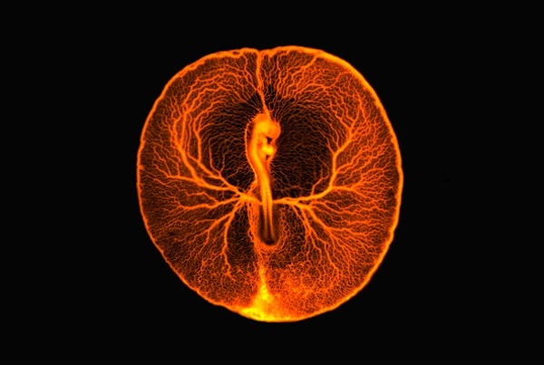 鸡胚胎血管系统（作者：VINCENT PASQUE, UNIVERSITY OF CAMBRIDGE）