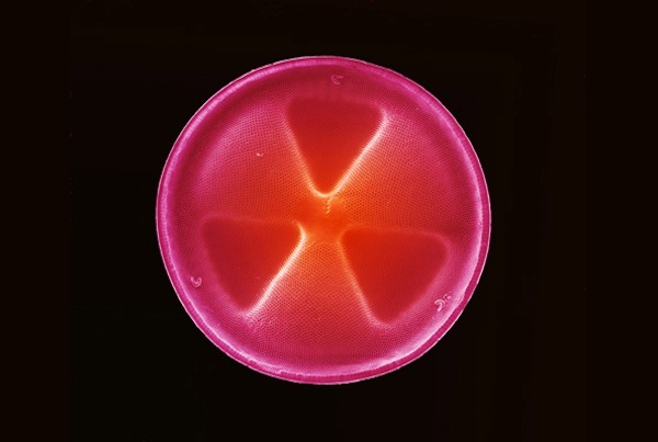 硅藻细胞壁（作者：ANNE WESTON, LONDON RESEARCH INSTITUTE, CANCER RESEARCH UK）