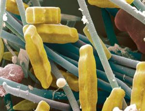 硅藻可喜欢铁了~~（Power and Syred/Science Photo Library）