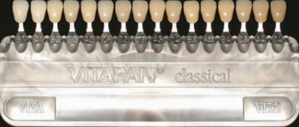 图片来自：nhsdentistgoole.com/teeth_whitening_in_goole。英文字母4种颜色倾向：A代表红棕色，B代表红黄色，C代表灰色，D代表红灰色。阿拉伯字母表示变色程度。例如：C3表示患者的牙齿属于跨度四环素牙；A3.5，则表示表示患者的牙齿是明显黄牙。