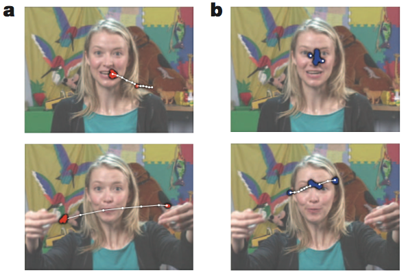 自闭症儿童治疗发现新曙光