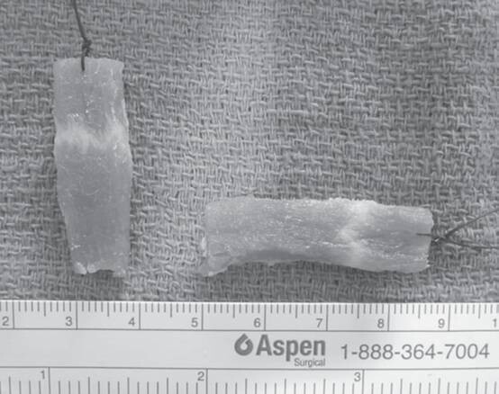 【搞笑诺奖】医学奖：流鼻血？上腌猪肉条！