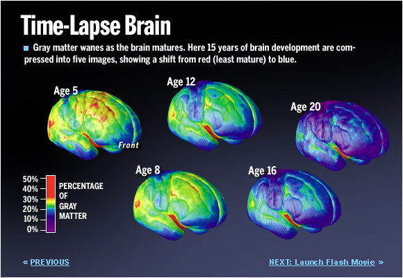 青少年恶习如何防患于未然？扫描一下大脑吧