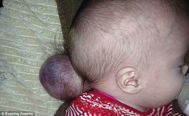 胚胎发育中，大脑是如何匹配头骨的？