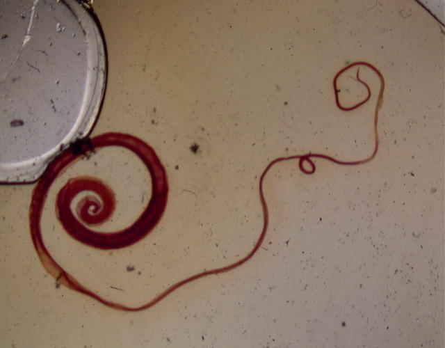 让“被忽视疾病”得到应有的重视