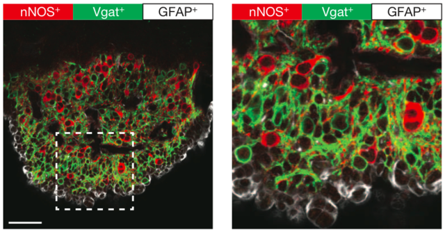 【论文故事】探寻脑中的渴觉“开关”