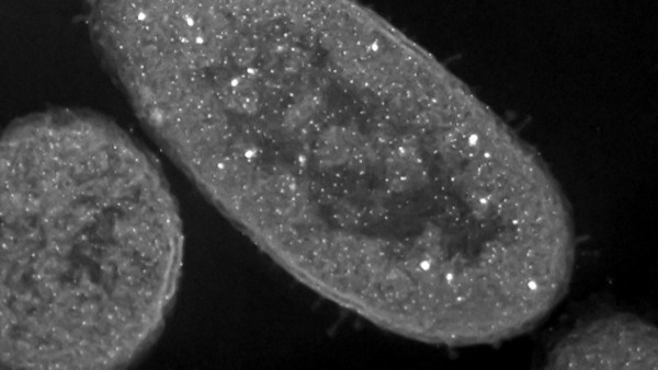 银离子：不仅杀菌，还让细菌变“僵尸”