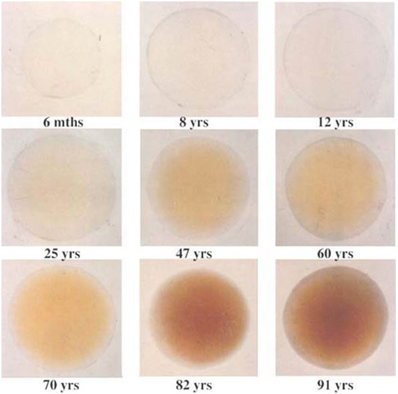 眼睛“防晒”，宝宝更需要