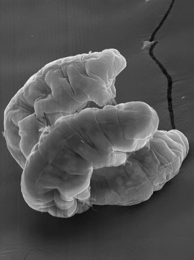 “杀不死”的水熊虫是何方神圣？