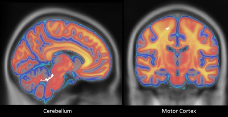 寸拳威力大，还得靠脑子