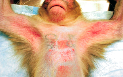 埃博拉：非洲死神来袭