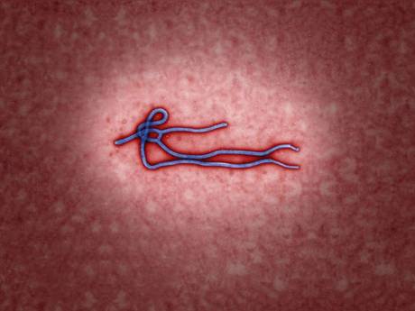 塞拉利昂“埃博拉”首席医生不幸牺牲