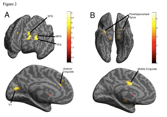 多学外语，锻炼大脑，现在也不晚