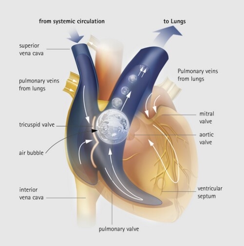 如何让推理小说写得更科学？【图文可能引起不适，请谨慎阅读】