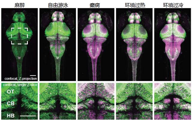 【论文故事】给神经活动拍个“钙片”