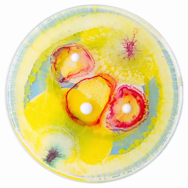 不止一花一世界，装满微生物的培养皿也是一个世界