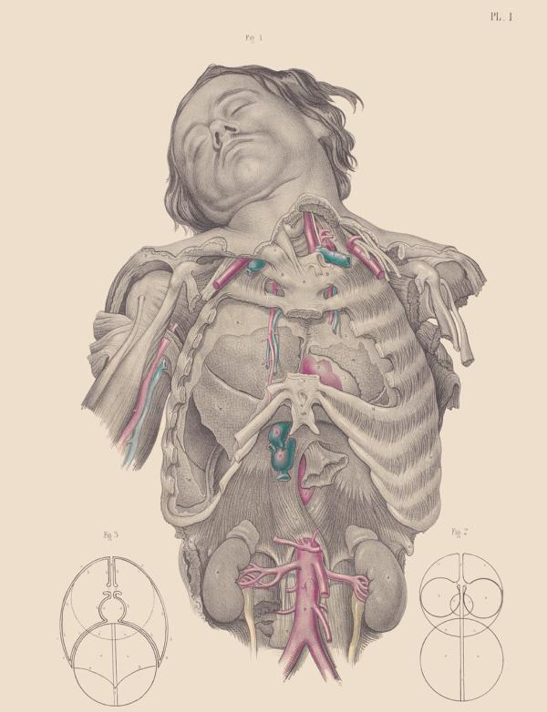 这些19世纪的外科手术图画，会不会让你庆幸自己活在现代？
