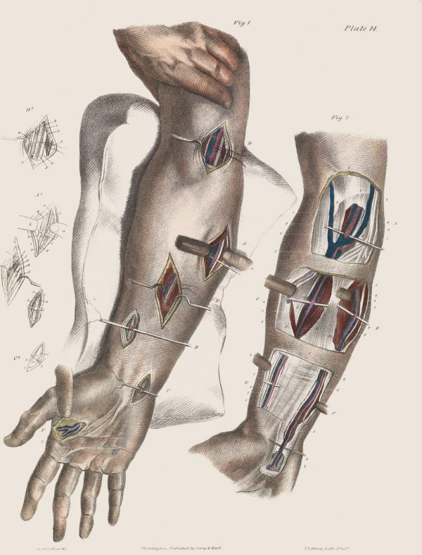 这些19世纪的外科手术图画，会不会让你庆幸自己活在现代？